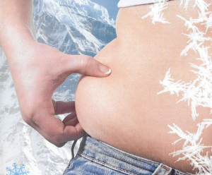 cryo03